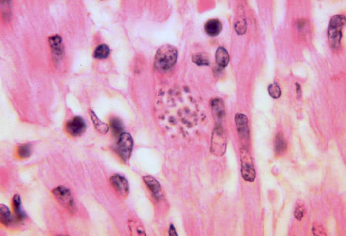 Trypanosoma cruzi